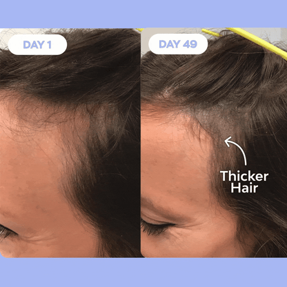 Hair Glowth Kit™
