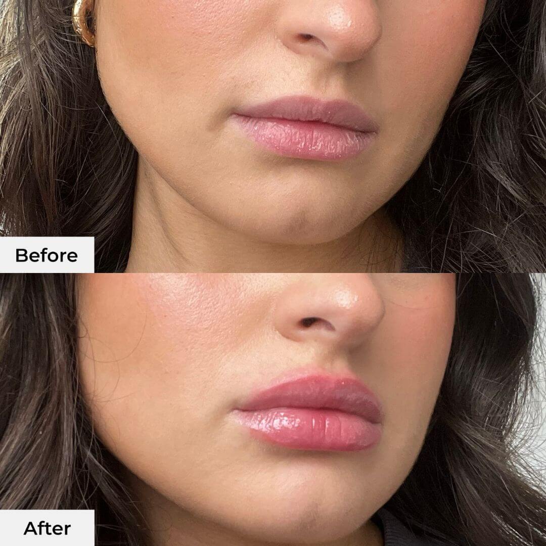 Instant Lip Plumper Pen