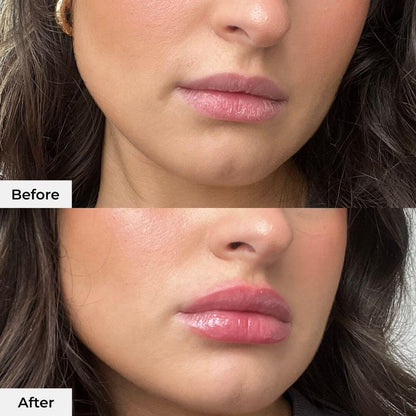 Instant Lip Plumper Pen